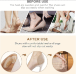 Heel Guards Cushion with Anti-Slip Beads - Image 2