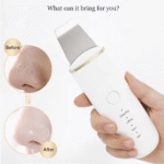 Ultrasonic Skin Scrubber Vibrate - Image 4