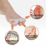 Toe Separator & Bunion Corrector - Image 2