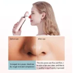 Mi Electric Blackhead Remover - Image 5