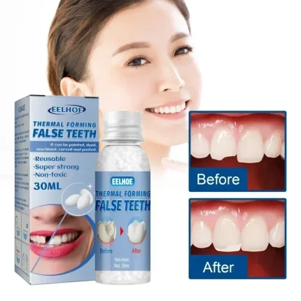 Resin Tooth Repair Glue Shapeable
