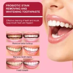 Sp4 Teeth Whitening Toothpaste Tooth - Image 3