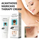 Creams For Dark Skin Body
