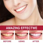 Sp4 Teeth Whitening Toothpaste Tooth - Image 5
