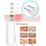 Ultrasonic Skin Scrubber - Image 4