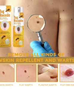 Alternative view of Tag recede