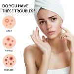 Acne Pimple Patch Invisible - Image 2