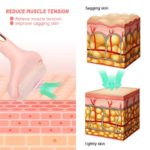 Facial Massage Ice Roller - Image 2