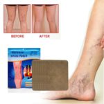 Herbal Varicose Vein Relief Patch for Leg Care