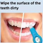 Portable 6-Piece Tooth Stain Removal Kit